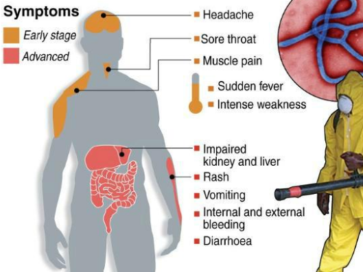 Simptome aparitie Ebola